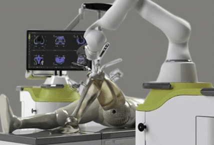 smart robotic knee surgery