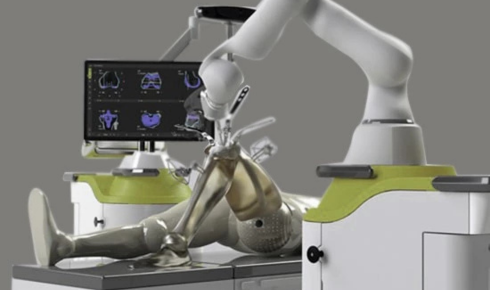 smart robotic knee surgery